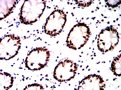 Figure 8:Immunohistochemical analysis of paraffin-embedded colon tissues using HDAC1 mouse mAb with DAB staining.