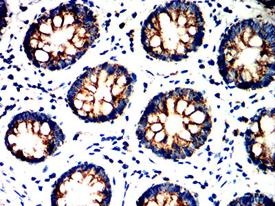 Figure 7:Immunohistochemical analysis of paraffin-embedded colon tissues using UQCRC1 mouse mAb with DAB staining.
