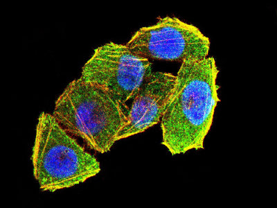 Figure 5:Immunofluorescence analysis of Hela cells using USP7 mouse mAb (green). Blue: DRAQ5 fluorescent DNA dye. Red: Actin filaments have been labeled with Alexa Fluor- 555 phalloidin. Secondary antibody from Fisher (Cat#: 35503)