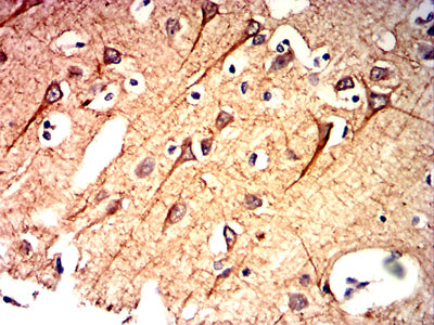 Figure 8:Immunohistochemical analysis of paraffin-embedded brain tissues using CD10 mouse mAb with DAB staining.