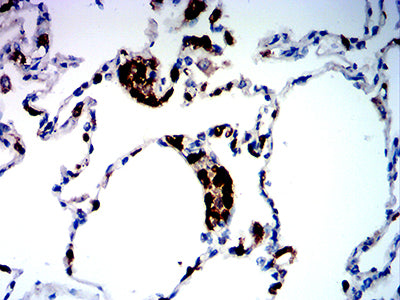 Figure 6:Immunohistochemical analysis of paraffin-embedded lung tissues using CD281 mouse mAb with DAB staining.