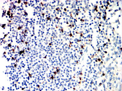 Figure 6:Immunohistochemical analysis of paraffin-embedded tonsil tissues using GZMK mouse mAb with DAB staining.