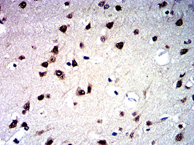 Figure 6:Immunohistochemical analysis of paraffin-embedded human brain tissues using HDAC1 mouse mAb with DAB staining.