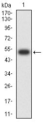 Figure 2:Western blot analysis using KRT9 mAb against human KRT9 (AA: 153-460) recombinant protein. (Expected MW is 51.7 kDa)