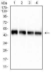 Figure 2:Western blot analysis using P22 mAb against human P22 (AA: 29-177) recombinant protein. lane 1 :(100 ng); lane 2 :(50 ng); lane 3 :(25 ng); lane 4 :(10 ng); lane 5 :(2.5 ng); (Expected MW is 42.9 kDa)