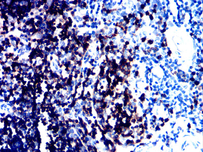 Figure 5:Immunohistochemical analysis of paraffin-embedded thymus tissues using CD1A mouse mAb with DAB staining.