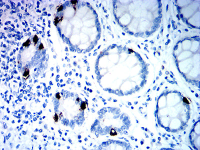 Figure 7:Immunohistochemical analysis of paraffin-embedded rectum tissues using SIGLEC8 mouse mAb with DAB staining.