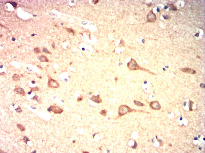 Figure 6:Immunohistochemical analysis of paraffin-embedded brain tissues using GPR83 mouse mAb with DAB staining.