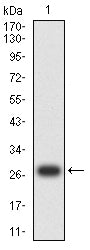 Figure 2:Western blot analysis using CD220 mAb against human CD220 (AA: extra 413-624) recombinant protein. (Expected MW is 27.8 kDa)