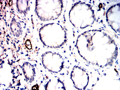 Figure 6:Immunohistochemical analysis of paraffin-embedded rectum tissues using CD105 mouse mAb with DAB staining.