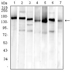 Figure 4:Western blot analysis using MSH6 mouse mAb against SH-SY5Y (1), Hela (2), PC-3 (3), HCT116 (4), HEK293 (5), A549 (6), and HepG2 (7) cell lysate.