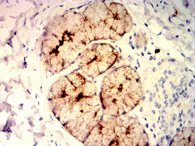 Figure 5:Immunohistochemical analysis of paraffin-embedded esophagus tissues using CEACAM6 mouse mAb with DAB staining.