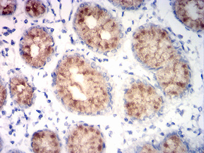 Figure 5: Immunohistochemical analysis of paraffin-embedded stomach tissues using MUC5AC mouse mAb with DAB staining.