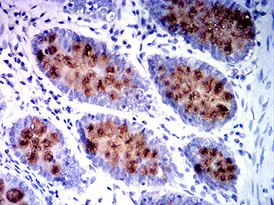 Figure 5: Immunohistochemical analysis of paraffin-embedded colon tissues using MUC2 mouse mAb with DAB staining.