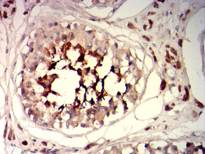Figure 7: Immunohistochemical analysis of paraffin-embedded testis tissues using SP17 mouse mAb with DAB staining.
