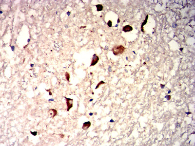 Figure 6: Immunohistochemical analysis of paraffin-embedded brain tissues using HAS1 mouse mAb with DAB staining.