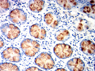 Figure 6: Immunohistochemical analysis of paraffin-embedded colon tissues using MUC2 mouse mAb with DAB staining.