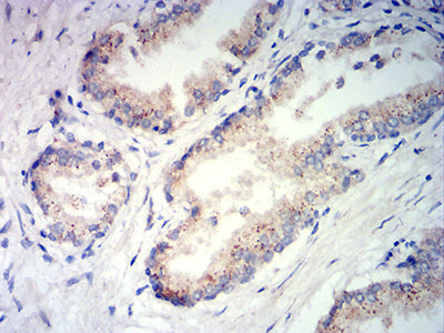 Figure 7: Immunohistochemical analysis of paraffin-embedded prostate tissues using PSAP mouse mAb with DAB staining.