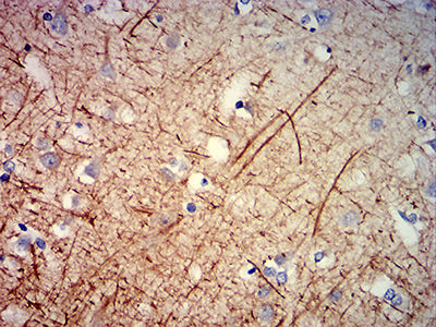 Figure 4: Immunohistochemical analysis of paraffin-embedded human cerebrum tissues using NEFH mouse mAb with DAB staining.