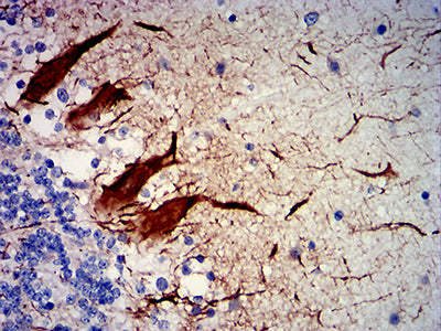 Figure 5: Immunohistochemical analysis of paraffin-embedded human cerebellum tissues using NEFH mouse mAb with DAB staining.