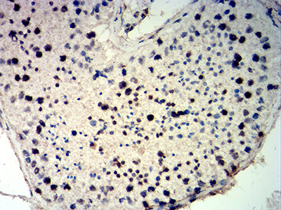 Figure 6: Immunohistochemical analysis of paraffin-embedded testis tissues using CDKN1C mouse mAb with DAB staining.