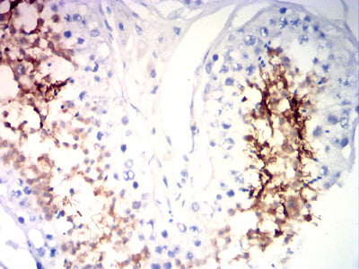 Figure 5: Immunohistochemical analysis of paraffin-embedded testi tissues using SP17 mouse mAb with DAB staining.