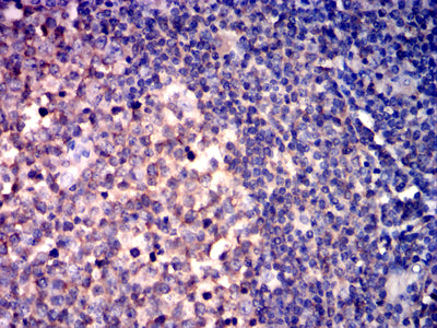 Figure 7: Immunohistochemical analysis of paraffin-embedded lymphoid tissues using CD267 mouse mAb with DAB staining.