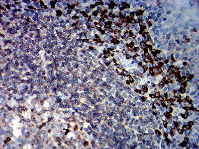 Figure 8: Immunohistochemical analysis of paraffin-embedded tonsil tissues using CD45R mouse mAb with DAB staining.