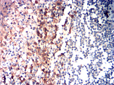 Figure 5: Immunohistochemical analysis of paraffin-embedded tonsil tissues using CD85G mouse mAb with DAB staining.