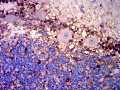 Figure 6: Immunohistochemical analysis of paraffin-embedded cerebellar tissues using GLUL mouse mAb with DAB staining.