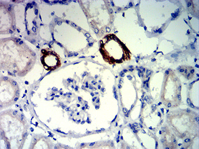 Figure 6: Immunohistochemical analysis of paraffin-embedded kidney tissues using FLI1 mouse mAb with DAB staining.