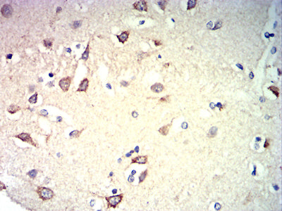 Figure 6: Immunohistochemical analysis of paraffin-embedded brain tissues using CD57 mouse mAb with DAB staining.