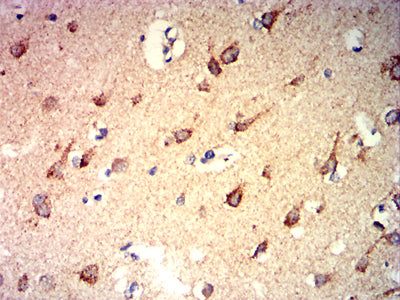 Figure 6: Immunohistochemical analysis of paraffin-embedded brain tissues using CD57 mouse mAb with DAB staining.