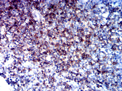 Figure 6: Immunohistochemical analysis of paraffin-embedded tonsil tissues using CD5 mouse mAb with DAB staining.