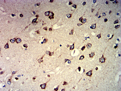 Figure 7: Immunohistochemical analysis of paraffin-embedded brain tissues using CCND1 mouse mAb with DAB staining.