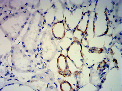 Figure 7: Immunohistochemical analysis of paraffin-embedded kidney tissues using ERCC1 mouse mAb with DAB staining.