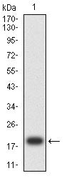 Figure 2: Western blot analysis using CDKN2A mAb against human CDKN2A (AA: 1-156) recombinant protein. (Expected MW is 19.4 kDa)