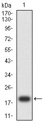 Figure 2: Western blot analysis using CD7 mAb against human CD7 (AA: 26-180) recombinant protein. (Expected MW is 19.3 kDa)