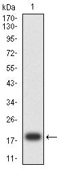 Figure 2: Western blot analysis using CD3D mAb against human CD3D (AA: 127-171) recombinant protein. (Expected MW is 18.6 kDa)