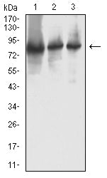 Figure 4: Western blot analysis using RRM1 mouse mAb against Hela (1), Jurkat (2), and A431 (3) cell lysate.