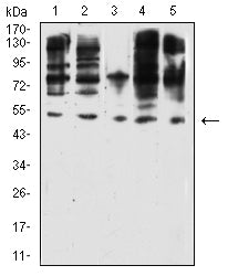 Figure 4: Western blot analysis using WT1 mouse mAb against K562 (1), COS7 (2), SK-OV-3 (3), Hela (4), and PC-3 (5) cell lysate.
