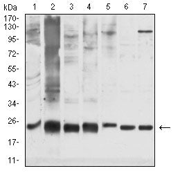 Figure 4: Western blot analysis using GSTP1 mouse mAb against PC-3 (1), K562 (2), Hela (3)，Jurkat (4), MOLT-4 (5), HCT116 (6), and A431 (7) cell lysate.