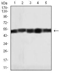 Figure 4: Western blot analysis using HAS1 mouse mAb against SK-BR-3 (1), SK-OV-3 (2),CHO (3),SW480 (4), and Hela (5) cell lysate.