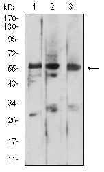 Figure 4: Western blot analysis using PSAP mouse mAb against HEK293 (1), C6 (2), and HT1080 (3) cell lysate.