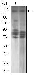 Figure 4: Western blot analysis using TET2 mouse mAb against HL-60 (1) and SK-N-SH (2) cell lysate.