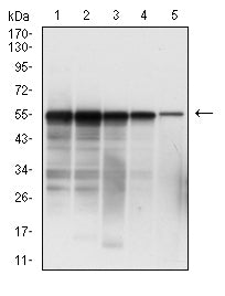 Figure 2: Western blot analysis using SARS-CoV-2-NP3 mAb against human SARS-CoV-2-N (AA: 1-419) recombinant protein. lane 1 :(100 ng); lane 2 :(50 ng); lane 3 :(25 ng); lane 4 :(10 ng); lane 5 :(2.5 ng); (Expected MW is 49.2 kDa)