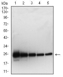 Figure 2: Western blot analysis using SARS-Cov2-NP2 mAb against human SARS-Cov2-N (AA: 120-300) recombinant protein. lane 1 :(100 ng); lane 2 :(50 ng); lane 3 :(25 ng); lane 4 :(10 ng); lane 5 :(2.5 ng); (Expected MW is 22.7 kDa)