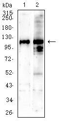 Figure 4: Western blot analysis using SALL4 mouse mAb against NIH/3T3 (1) C2C12 (2) cell lysate.