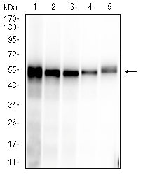 Figure 2: Western blot analysis using SARS-CoV-2-NP1 mAb against human SARS-CoV-2-N (AA: 1-419) recombinant protein. lane 1 :(100 ng); lane 2 :(50 ng); lane 3 :(25 ng); lane 4 :(10 ng); lane 5 :(2.5 ng); (Expected MW is 49.2 kDa)