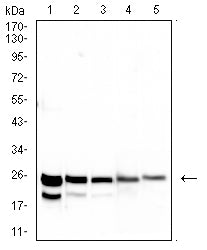 Figure 2: Western blot analysis using SARS-Cov2-NP1 mAb against human SARS-Cov2-N (AA: 1-180) recombinant protein. lane 1 :(100 ng); lane 2 :(50 ng); lane 3 :(25 ng); lane 4 :(10 ng); lane 5 :(2.5 ng); (Expected MW is 23 kDa)